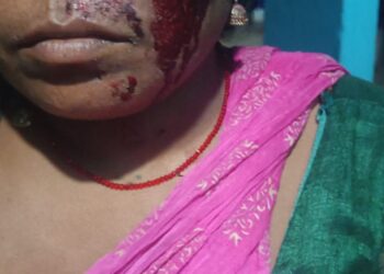 लकड़बग्घे के हमले से महिला घायल । एक पखवाड़े के अंदर तीसरी घटना से ग्रामीण भयभीत ।