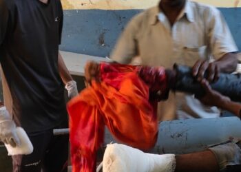 रेलवे ट्रैक पार करते वक्त ट्रेन की चपेट में आया युवकयुवक का दोनों पैर कटा, रेफर।