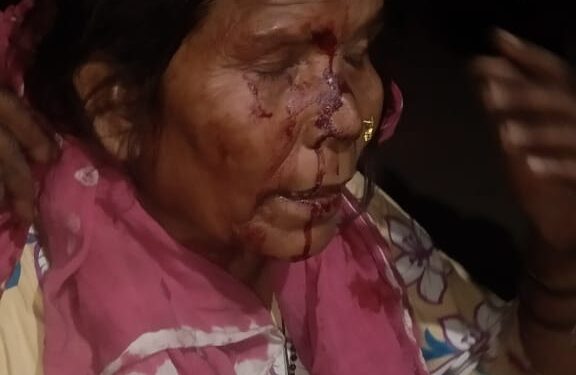 । शादी कार्यक्रम में डीजे पर नाचने को लेकर दो पक्षों में हुआ विवाद।