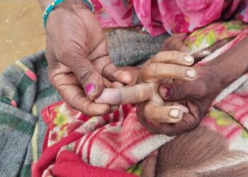 दिव्यांग महिला को सर्प दंश से मौत।
