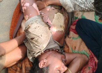 घरेलू लाइट बनाते समय युवक झुलसा हालत गम्भीर अस्पताल में भर्ती।