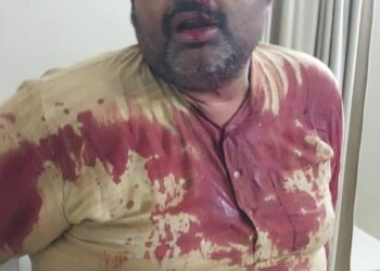अधिवक्ता के साथ मार पीट करने वाले पुलिस अधिकारी को बर्खास्त कर कठोर करवाई करे सरकार–राकेश शरण मिश्र।