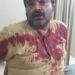अधिवक्ता के साथ मार पीट करने वाले पुलिस अधिकारी को बर्खास्त कर कठोर करवाई करे सरकार–राकेश शरण मिश्र।