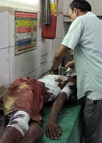 मछली मारने गये अधेड को मगरमच्छ ने किया लहू लुहान।